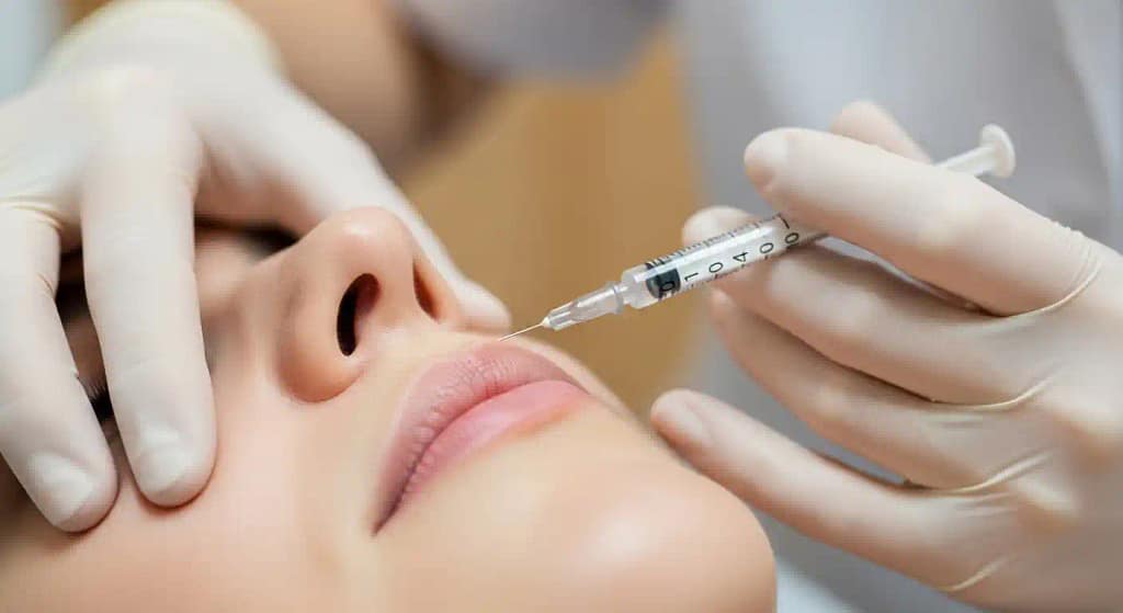 lip flip before and after botox injection